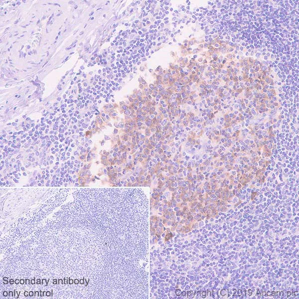 Immunohistochemistry (Formalin/PFA-fixed paraffin-embedded sections) - Anti-AICDA antibody [EPR23436-45] - ChIP Grade - BSA and Azide free (AB269457)
