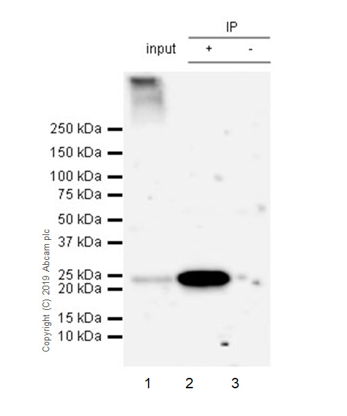 Immunoprecipitation - Anti-AICDA antibody [EPR23436-45] - ChIP Grade - BSA and Azide free (AB269457), expandable thumbnail