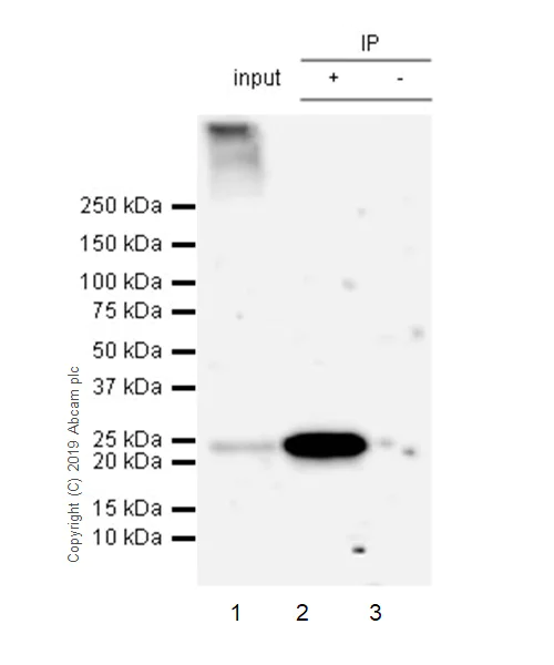 Immunoprecipitation - Anti-AICDA antibody [EPR23436-45] - ChIP Grade - BSA and Azide free (AB269457)