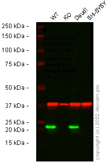 Western blot - Anti-AICDA antibody [EPR23436-45] - ChIP Grade - BSA and Azide free (ab269457), expandable thumbnail