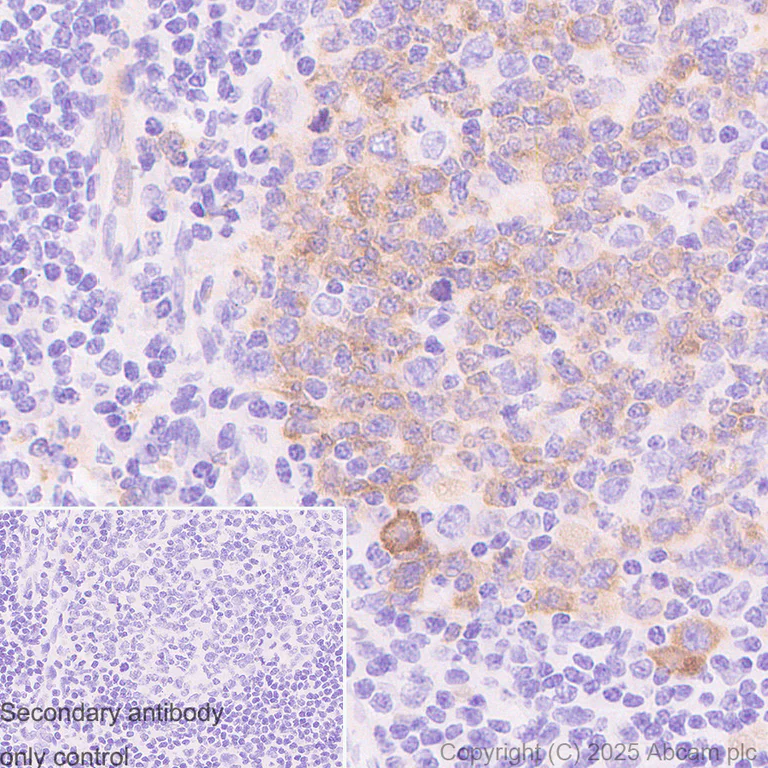 Immunohistochemistry (Formalin/PFA-fixed paraffin-embedded sections) - Anti-AICDA antibody [JUA51E] (AB323835)
