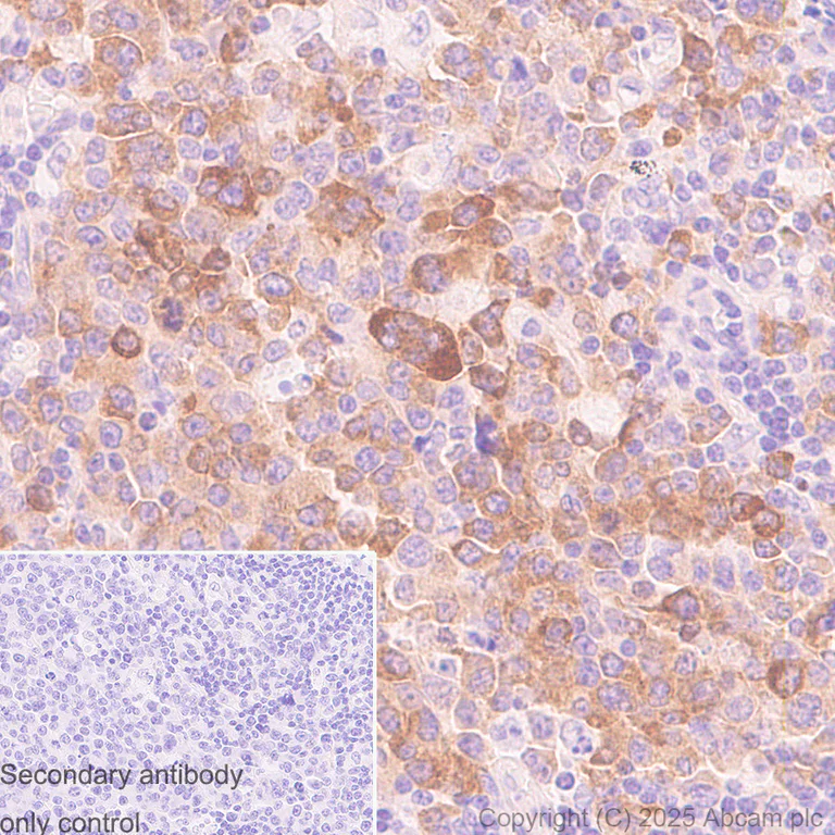 Immunohistochemistry (Formalin/PFA-fixed paraffin-embedded sections) - Anti-AICDA antibody [JUA51E] (AB323835)