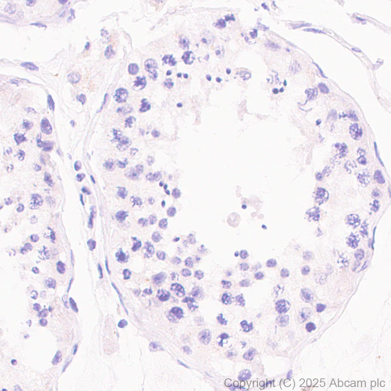 Immunohistochemistry (Formalin/PFA-fixed paraffin-embedded sections) - Anti-AICDA antibody [JUA51E] (AB323835)