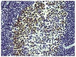 Immunohistochemistry (Formalin/PFA-fixed paraffin-embedded sections) - Anti-AICDA antibody [mAID-2] (AB169522), expandable thumbnail