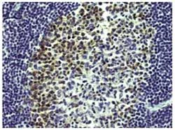 Immunohistochemistry (Formalin/PFA-fixed paraffin-embedded sections) - Anti-AICDA antibody [mAID-2] (AB169522)