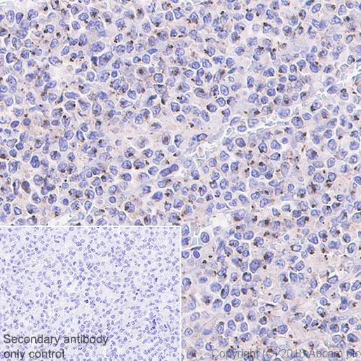 Immunohistochemistry (Formalin/PFA-fixed paraffin-embedded sections) - Anti-AICL antibody [EPR22061] (AB221158)