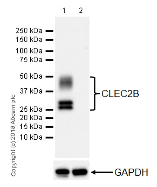 Western blot - Anti-AICL antibody [EPR22061] (AB221158)