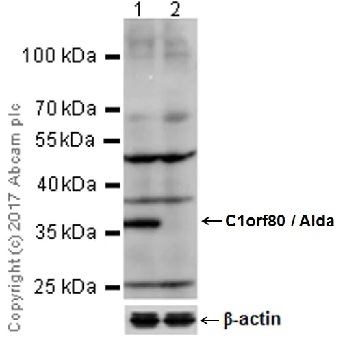 Western blot - Anti-AIDA antibody [EPR19161] (AB199323)