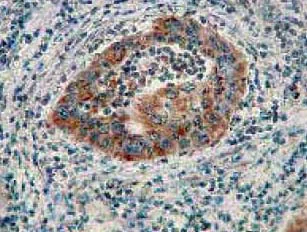 Immunohistochemistry (Formalin/PFA-fixed paraffin-embedded sections) - Anti-AIF antibody [E20] - BSA and Azide free (AB220215)