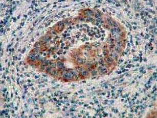 Immunohistochemistry (Formalin/PFA-fixed paraffin-embedded sections) - Anti-AIF antibody [E20] - Mitochondrial Marker (AB32516), expandable thumbnail