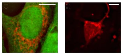 Immunocytochemistry/ Immunofluorescence - Anti-AIF antibody - Mitochondrial Marker (AB1998)