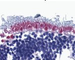 Immunohistochemistry (Formalin/PFA-fixed paraffin-embedded sections) - Anti-AIF antibody - Mitochondrial Marker (AB1998)