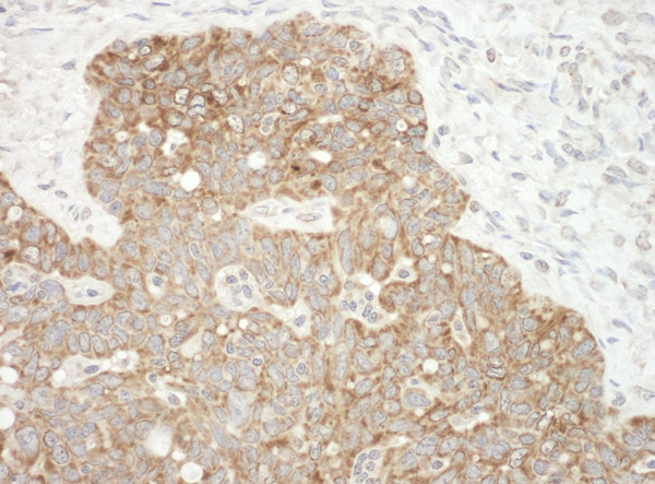 Immunohistochemistry (Formalin/PFA-fixed paraffin-embedded sections) - Anti-AIF antibody - Mitochondrial Marker (AB99437), expandable thumbnail