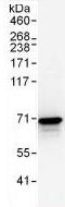 Immunoprecipitation - Anti-AIF antibody - Mitochondrial Marker (AB99437), expandable thumbnail