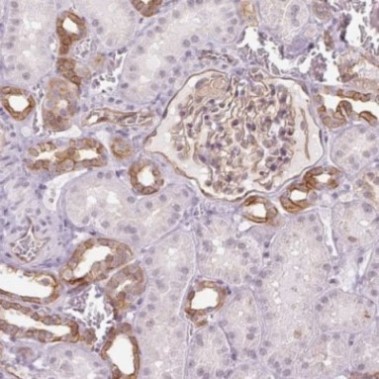 Immunohistochemistry (Formalin/PFA-fixed paraffin-embedded sections) - Anti-AIF1L antibody (AB204493)