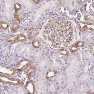 Immunohistochemistry (Formalin/PFA-fixed paraffin-embedded sections) - Anti-AIF1L antibody (AB204493)