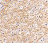 Immunohistochemistry (Formalin/PFA-fixed paraffin-embedded sections) - Anti-AIFM3 antibody (AB106359)