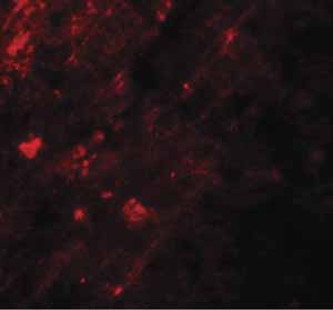 Immunocytochemistry/ Immunofluorescence - Anti-AIG1 antibody (AB140186)