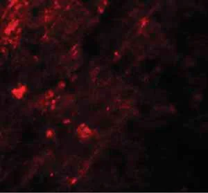 Immunocytochemistry/ Immunofluorescence - Anti-AIG1 antibody (AB140186)