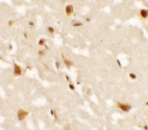 Immunohistochemistry (Formalin/PFA-fixed paraffin-embedded sections) - Anti-AIG1 antibody (AB140186)