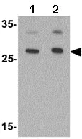 Western blot - Anti-AIG1 antibody (AB140186)
