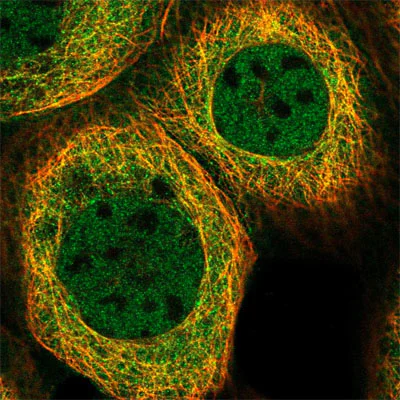Immunocytochemistry/ Immunofluorescence - Anti-AIM1 antibody (AB204846)
