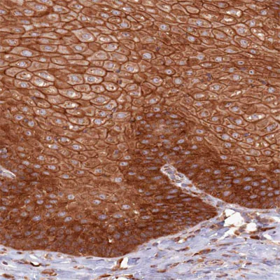 Immunohistochemistry (Formalin/PFA-fixed paraffin-embedded sections) - Anti-AIM1 antibody (AB204846)