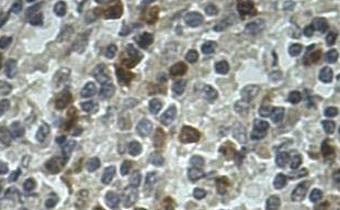Immunohistochemistry (Formalin/PFA-fixed paraffin-embedded sections) - Anti-AIM2 antibody (AB93015)