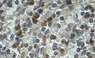 Anti-AIM2 antibody. Rabbit polyclonal (ab93015) | Abcam