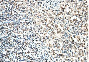 Immunohistochemistry (Formalin/PFA-fixed paraffin-embedded sections) - Anti-AIM2 antibody (AB93015)