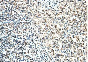Immunohistochemistry (Formalin/PFA-fixed paraffin-embedded sections) - Anti-AIM2 antibody (AB93015)