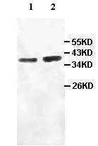 Western blot - Anti-AIM2 antibody (AB93015)