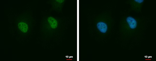 Immunocytochemistry/ Immunofluorescence - Anti-AIMP2/p38 antibody (AB228004), expandable thumbnail