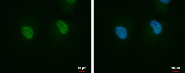 Immunocytochemistry/ Immunofluorescence - Anti-AIMP2/p38 antibody (AB228004)