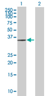 Western blot - Anti-AIMP2/p38 antibody (AB67471)