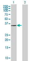 Western blot - Anti-AIMP2/p38 antibody (AB67471)