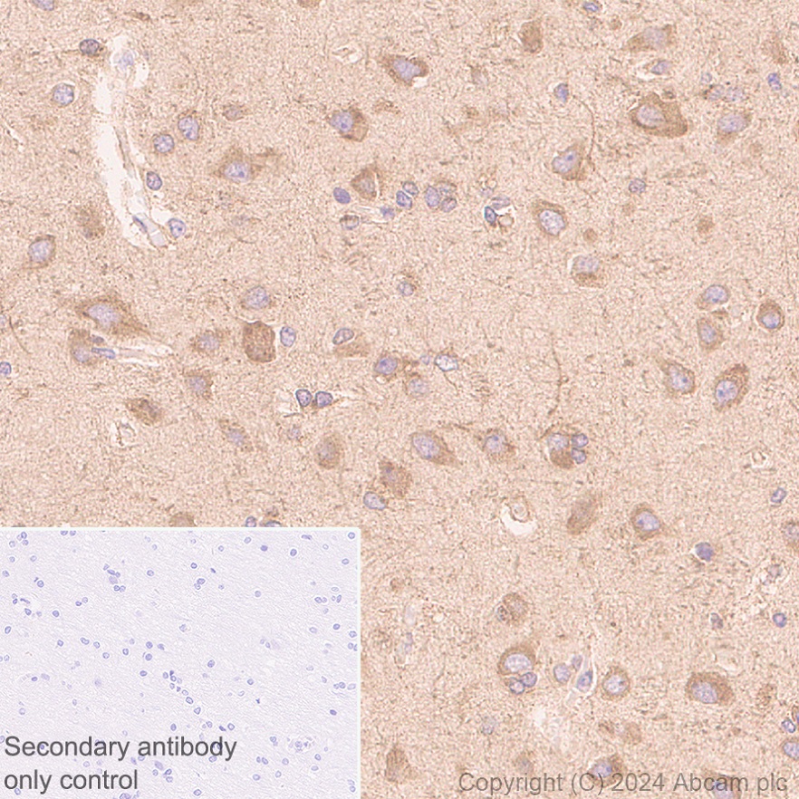 Immunohistochemistry (Formalin/PFA-fixed paraffin-embedded sections) - Anti-AIMP2/p38 antibody [EPR29127-48] - BSA and Azide free (ab316938), expandable thumbnail