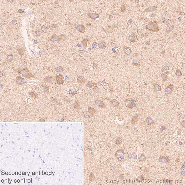 Immunohistochemistry (Formalin/PFA-fixed paraffin-embedded sections) - Anti-AIMP2/p38 antibody [EPR29127-48] - BSA and Azide free (AB316938)