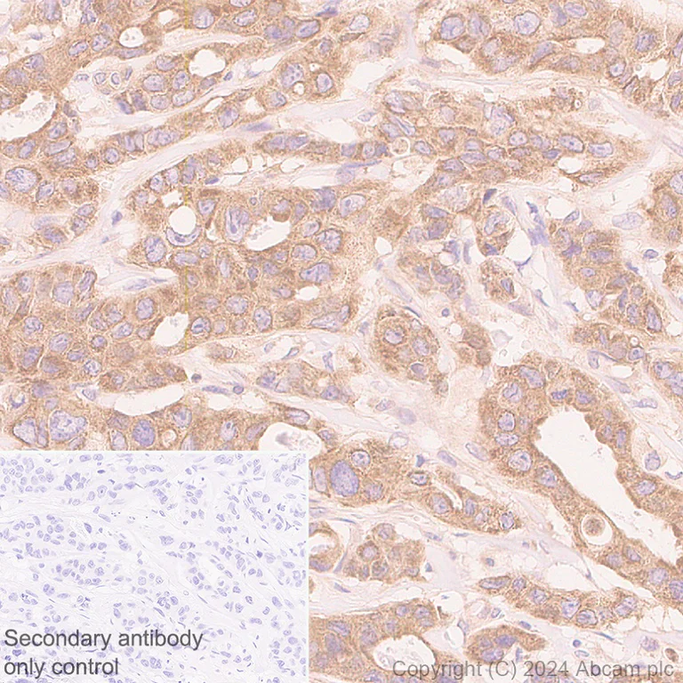 Immunohistochemistry (Formalin/PFA-fixed paraffin-embedded sections) - Anti-AIMP2/p38 antibody [EPR29127-48] - BSA and Azide free (AB316938)