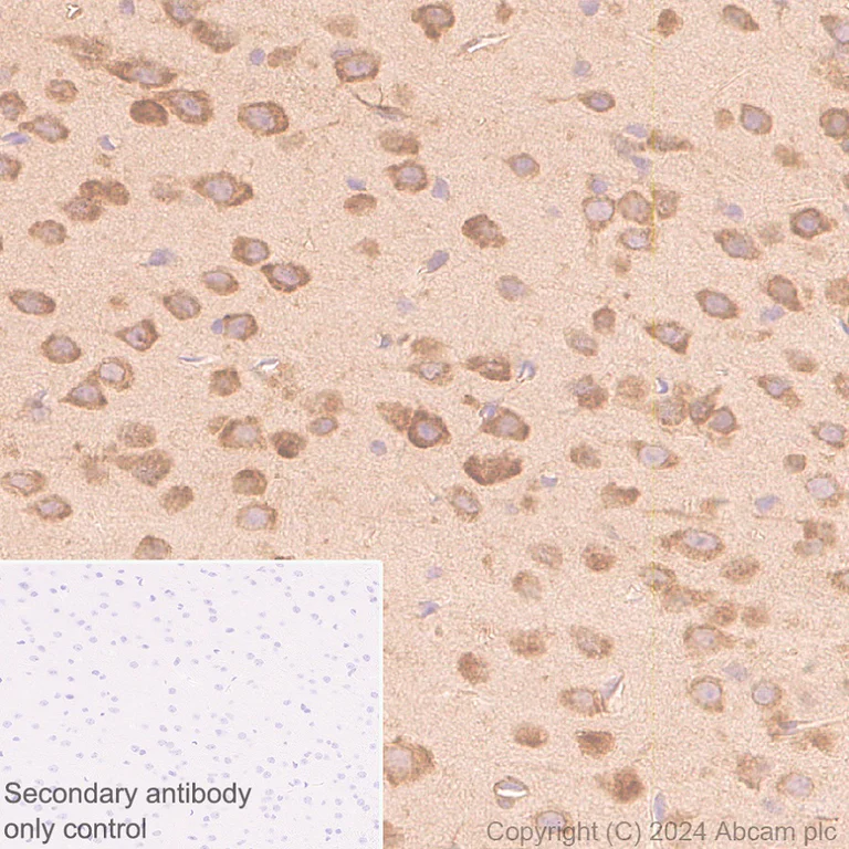 Immunohistochemistry (Formalin/PFA-fixed paraffin-embedded sections) - Anti-AIMP2/p38 antibody [EPR29127-48] - BSA and Azide free (AB316938)