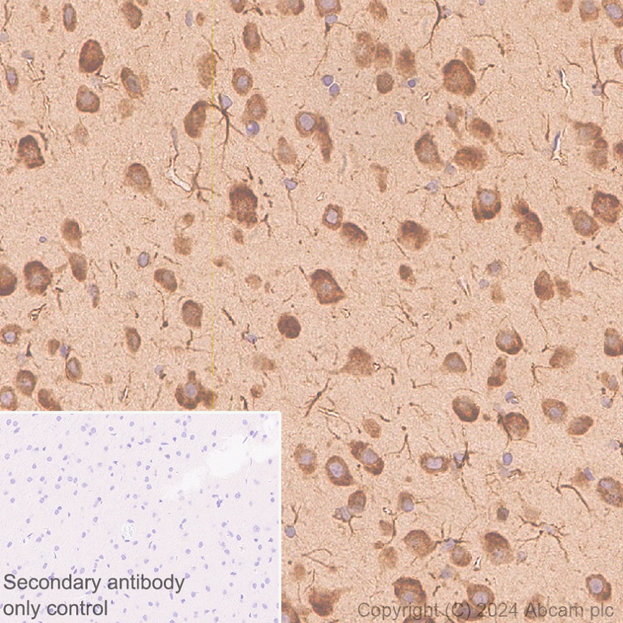 Immunohistochemistry (Formalin/PFA-fixed paraffin-embedded sections) - Anti-AIMP2/p38 antibody [EPR29127-48] - BSA and Azide free (AB316938), expandable thumbnail