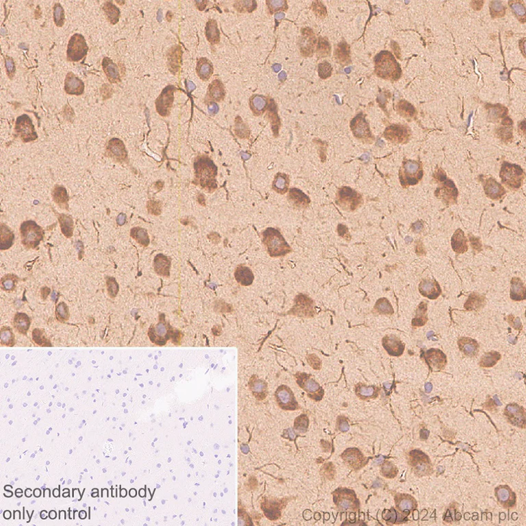 Immunohistochemistry (Formalin/PFA-fixed paraffin-embedded sections) - Anti-AIMP2/p38 antibody [EPR29127-48] - BSA and Azide free (AB316938)