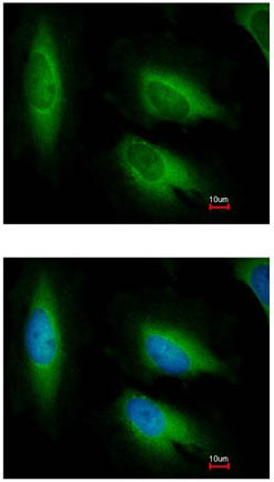 Immunocytochemistry/ Immunofluorescence - Anti-AIMP3/p18 antibody (AB155689), expandable thumbnail