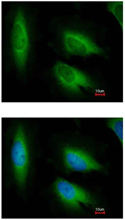 Immunocytochemistry/ Immunofluorescence - Anti-AIMP3/p18 antibody (AB155689)