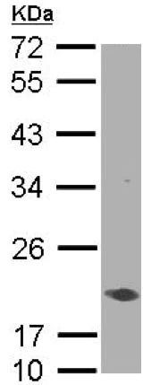 Western blot - Anti-AIMP3/p18 antibody (AB155689)