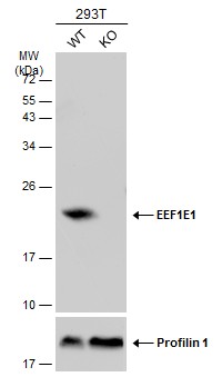 Western blot - Anti-AIMP3/p18 antibody (AB155689), expandable thumbnail