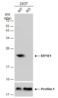 Western blot - Anti-AIMP3/p18 antibody (AB155689)