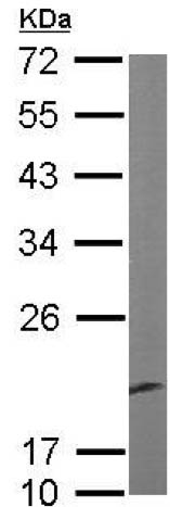 Western blot - Anti-AIMP3/p18 antibody (AB155689), expandable thumbnail
