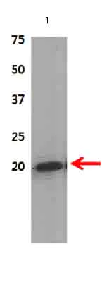 Western blot - Anti-AIMP3/p18 antibody (AB31543)