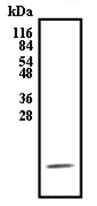 Western blot - Anti-AIMP3/p18 antibody (AB31543), expandable thumbnail